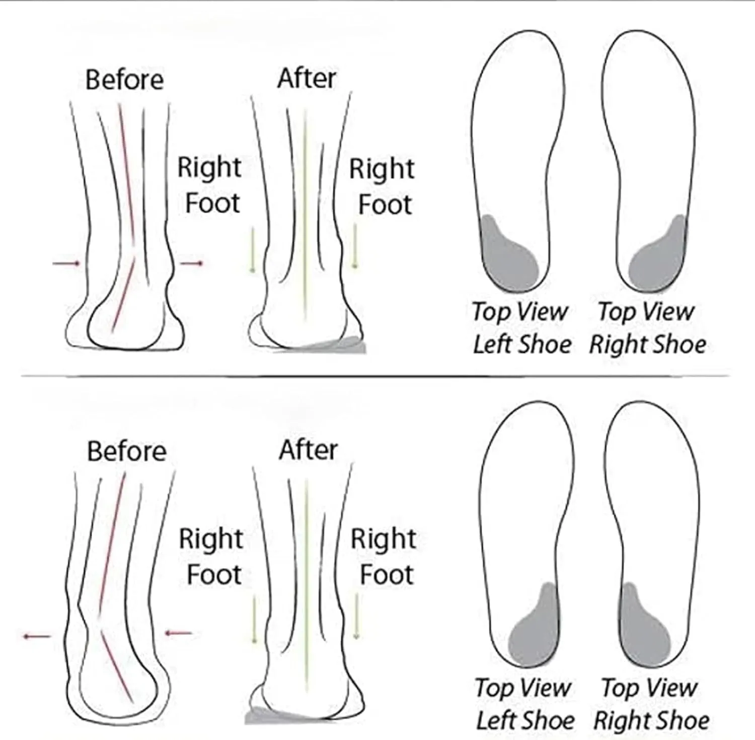 Women's Soft Sole Mesh Comfort Orthopedic Shoes, New Slip-on Walking Shoes with Arch Support
